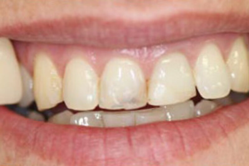 Before - Cheadle Hulme Dental