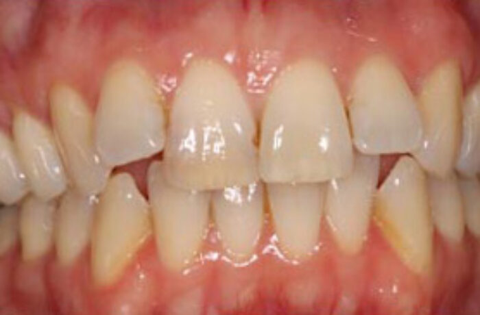 Before - Cheadle Hulme Dental