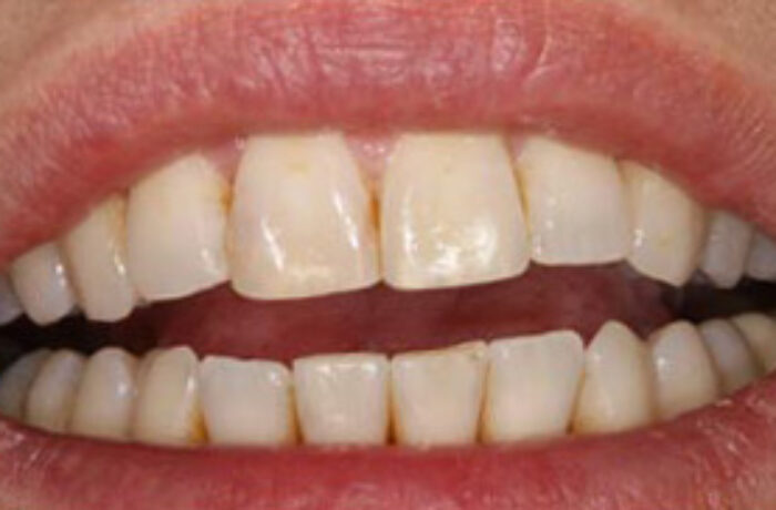 After - Cheadle Hulme Dental