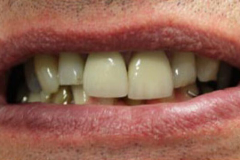 Before - Cheadle Hulme Dental