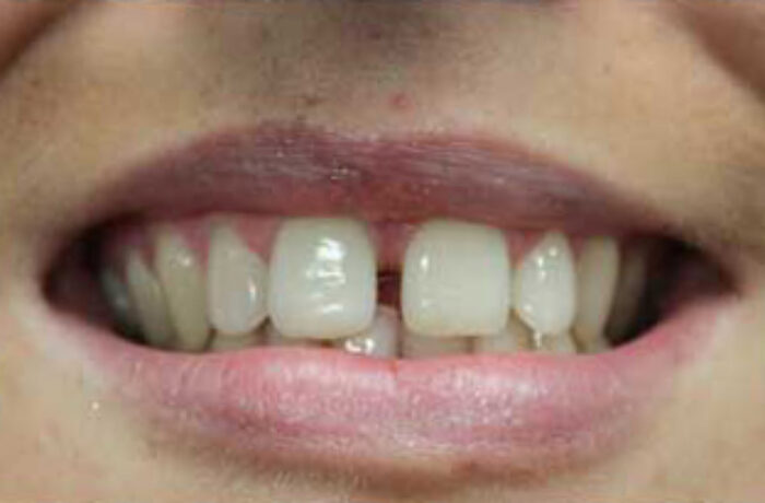 Before - Cheadle Hulme Dental