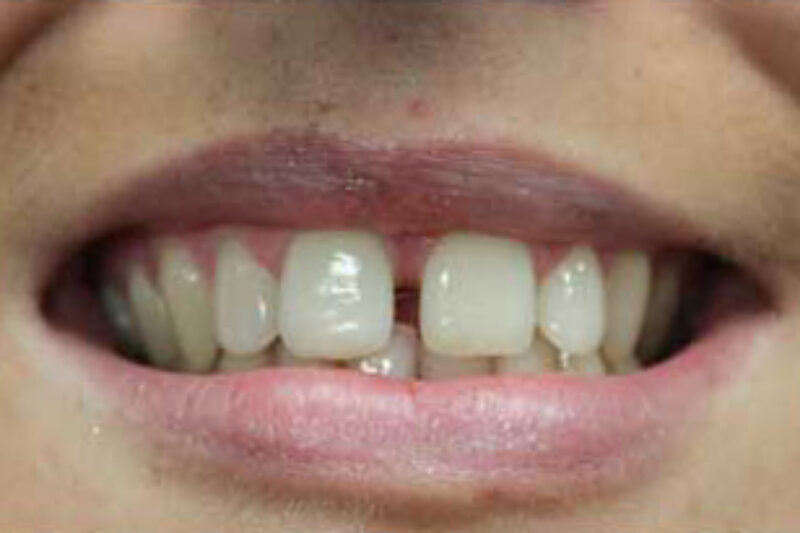 Before - Cheadle Hulme Dental