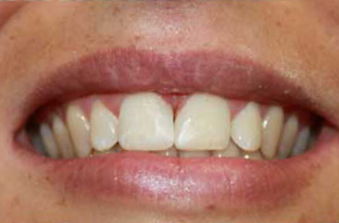 After - Cheadle Hulme Dental