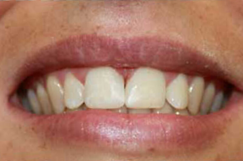 After - Cheadle Hulme Dental