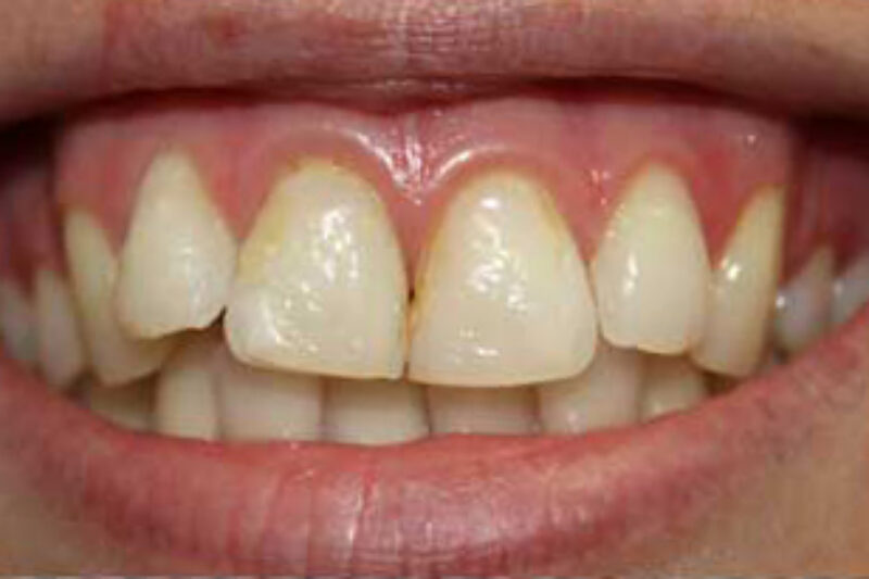 Before - Cheadle Hulme Dental