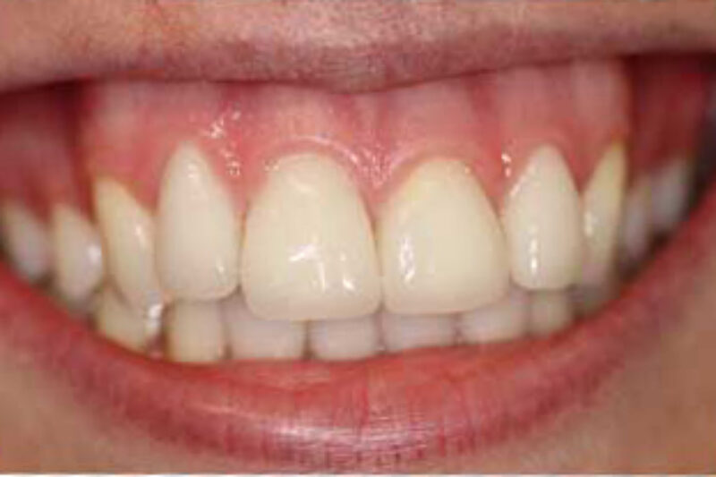 After - Cheadle Hulme Dental