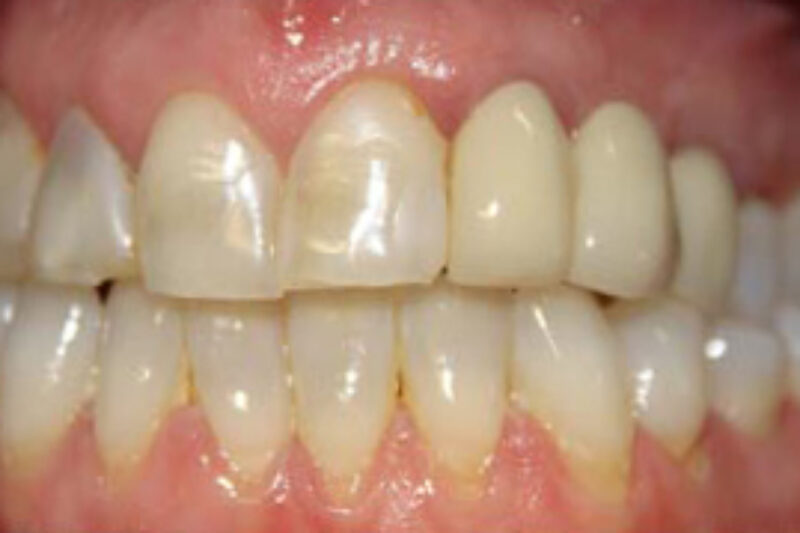 Before - Cheadle Hulme Dental