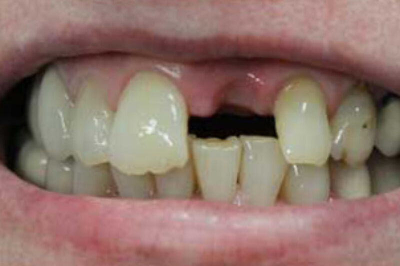 Before - Cheadle Hulme Dental