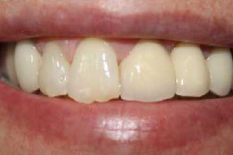 After - Cheadle Hulme Dental