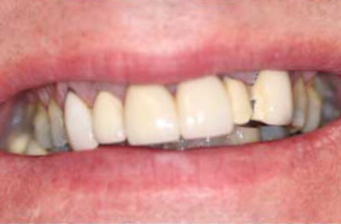 Before - Cheadle Hulme Dental