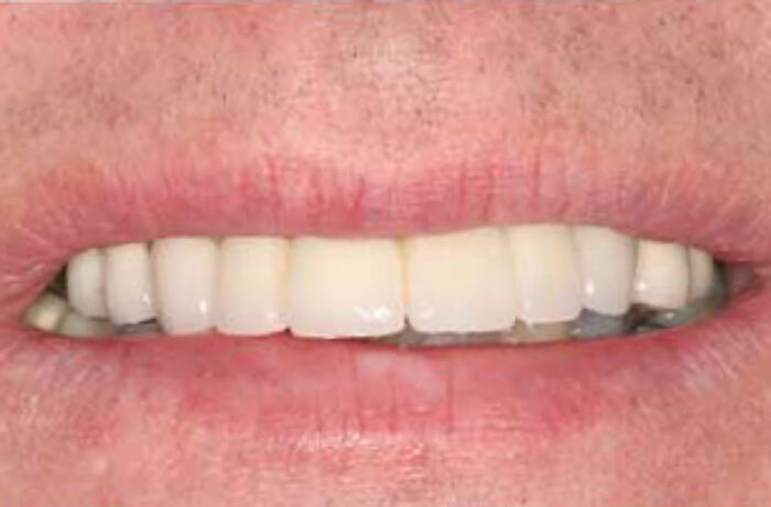 After - Cheadle Hulme Dental