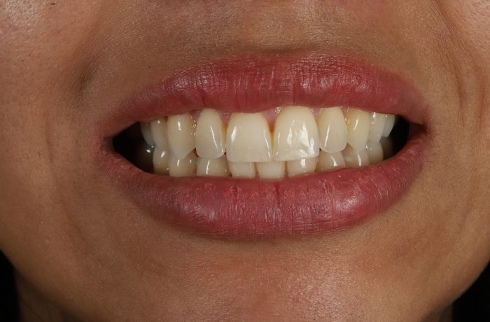 After - Cheadle Hulme Dental