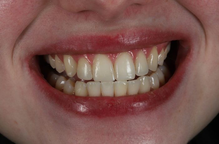 After - Cheadle Hulme Dental