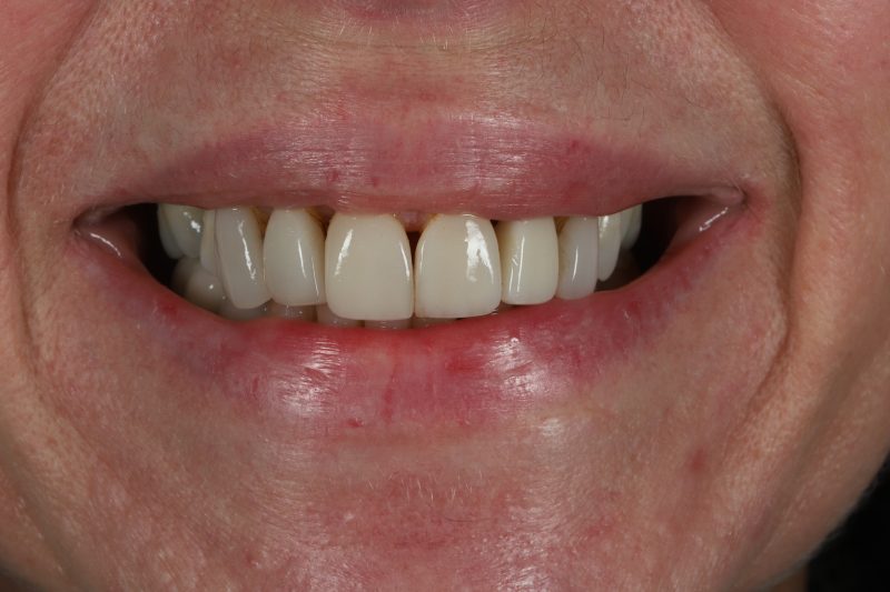 Before - Cheadle Hulme Dental