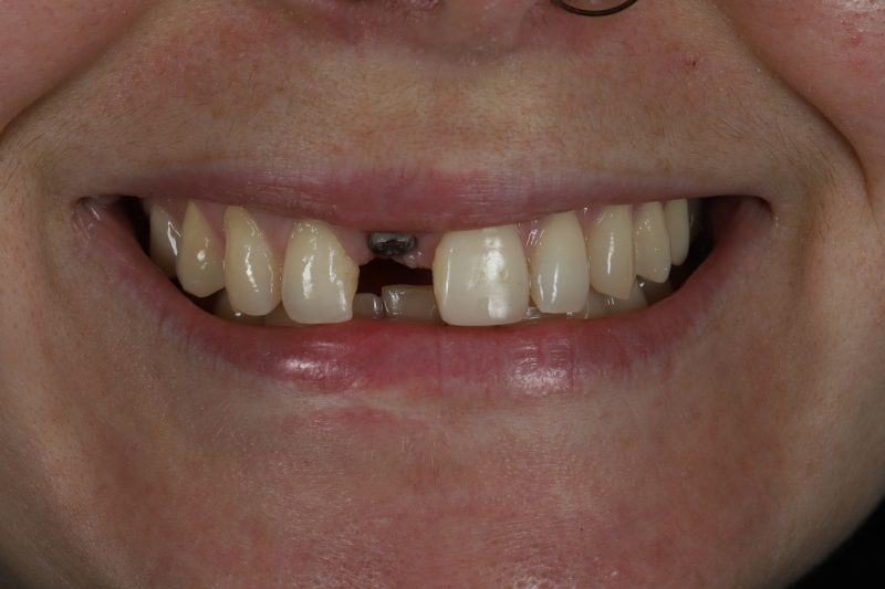 Before - Cheadle Hulme Dental