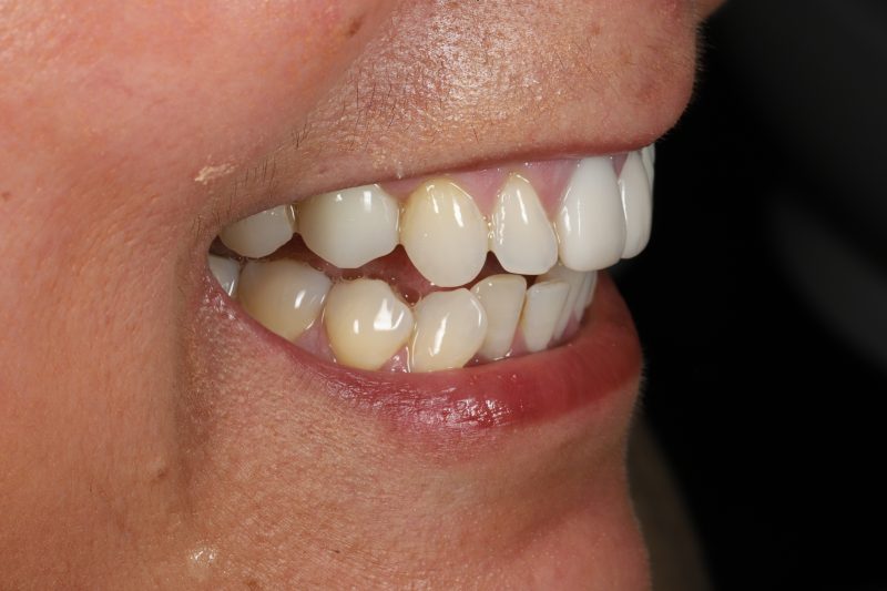 After - Cheadle Hulme Dental