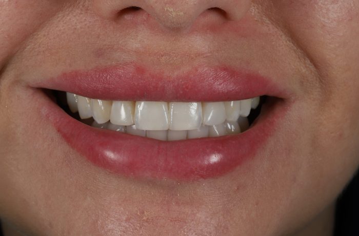 After - Cheadle Hulme Dental