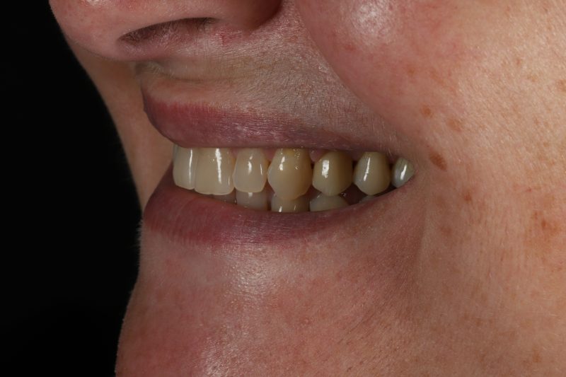 After - Cheadle Hulme Dental