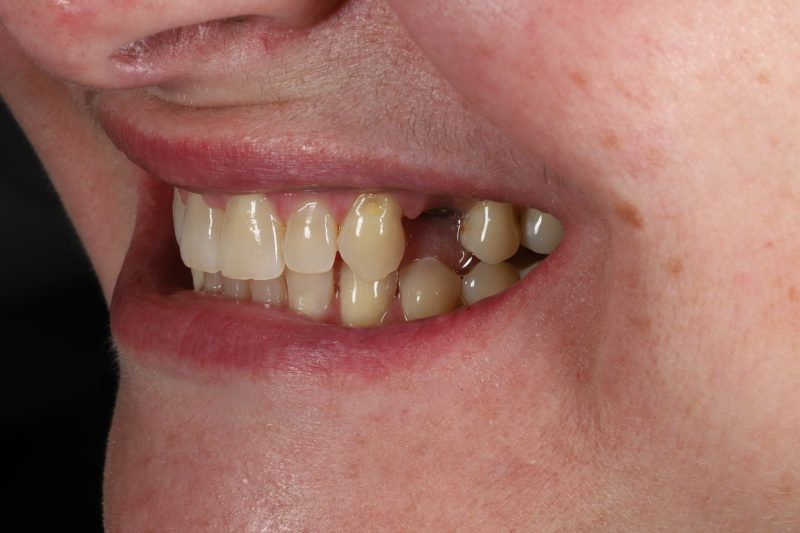 Before - Cheadle Hulme Dental