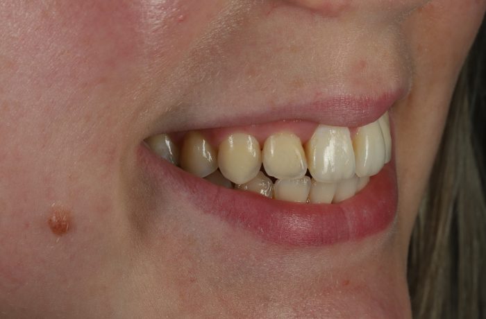 After - Cheadle Hulme Dental