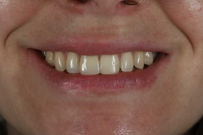 After - Cheadle Hulme Dental