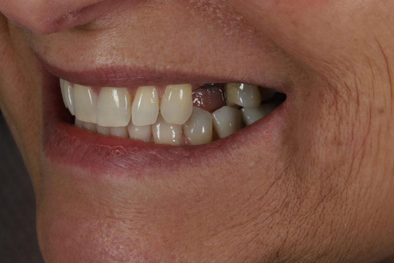 Before - Cheadle Hulme Dental