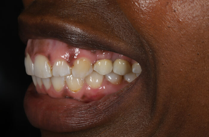 After - Cheadle Hulme Dental