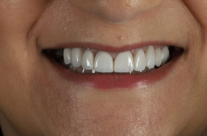 After - Cheadle Hulme Dental