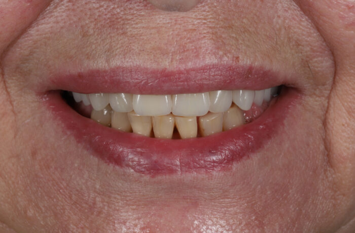 Before - Cheadle Hulme Dental