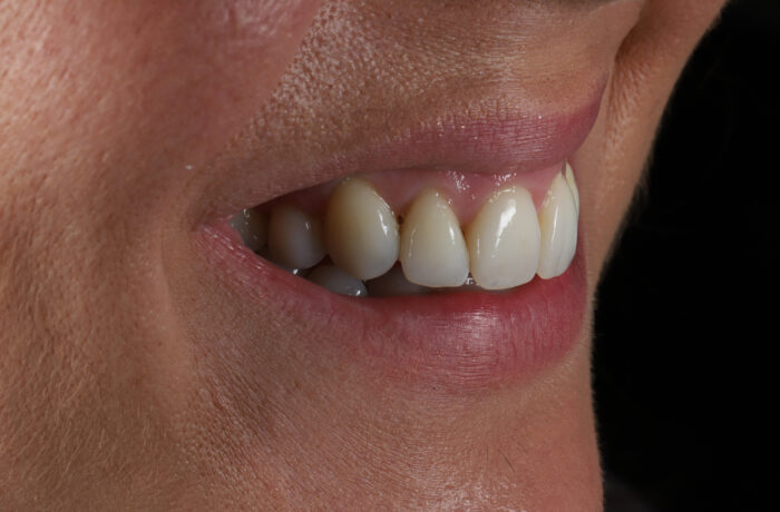 After - Cheadle Hulme Dental