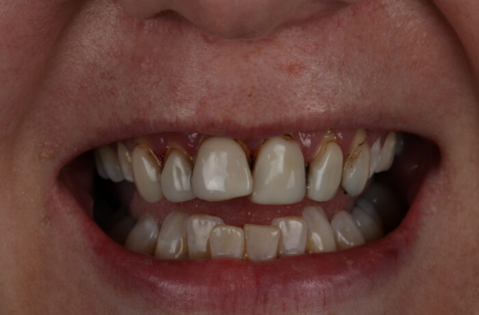 Before - Cheadle Hulme Dental