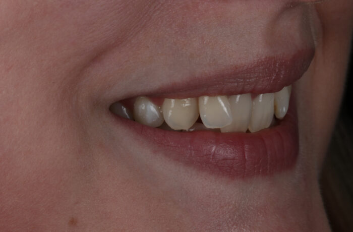 Before - Cheadle Hulme Dental