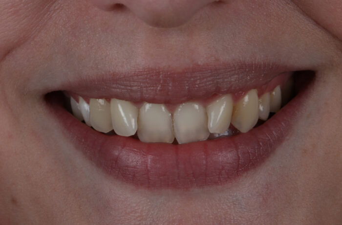 Before - Cheadle Hulme Dental