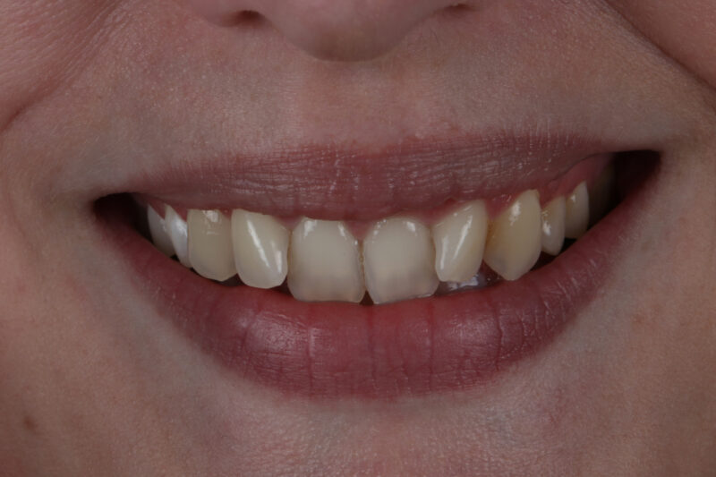 Before - Cheadle Hulme Dental