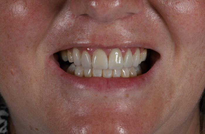 After - Cheadle Hulme Dental