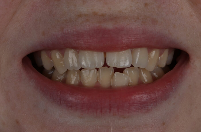 Before - Cheadle Hulme Dental