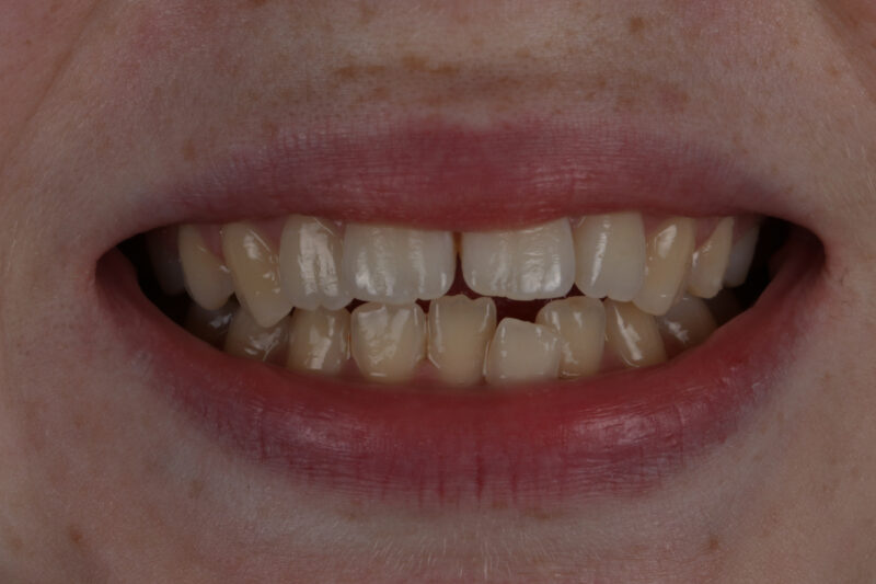 Before - Cheadle Hulme Dental