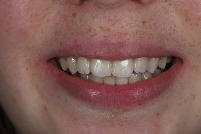 After - Cheadle Hulme Dental