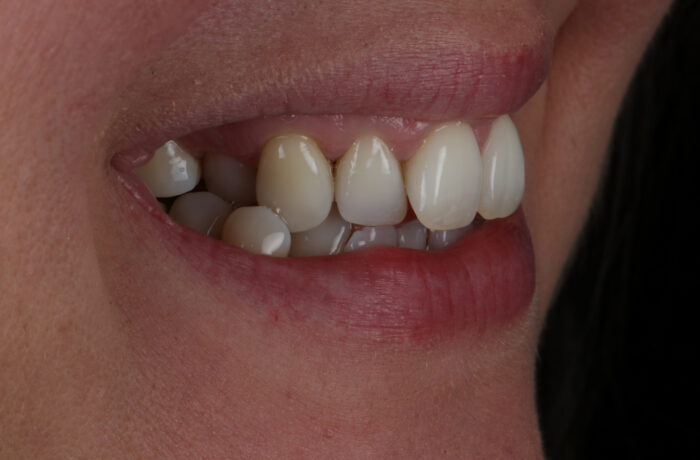 Before - Cheadle Hulme Dental