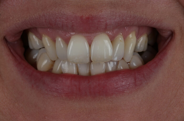 Before - Cheadle Hulme Dental