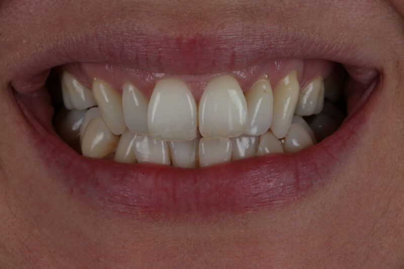 Before - Cheadle Hulme Dental