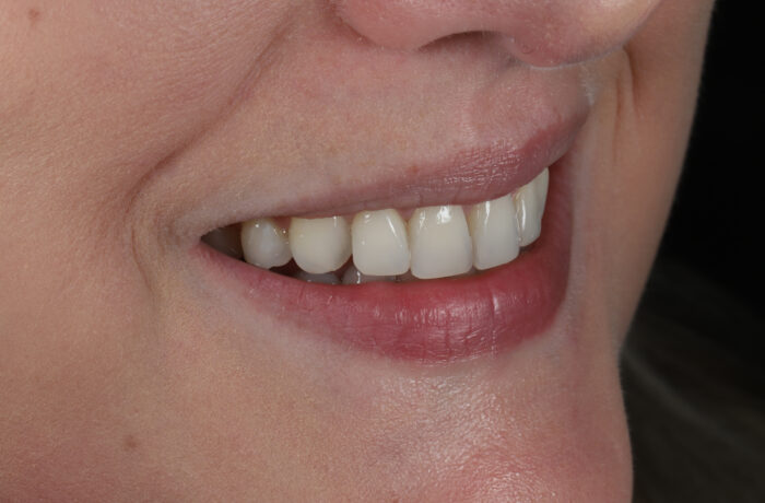 After - Cheadle Hulme Dental