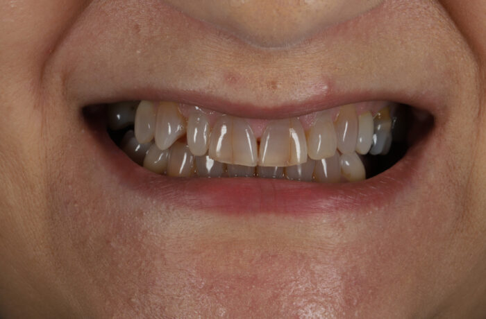 Before - Cheadle Hulme Dental