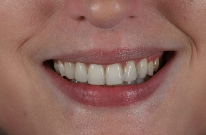 After - Cheadle Hulme Dental