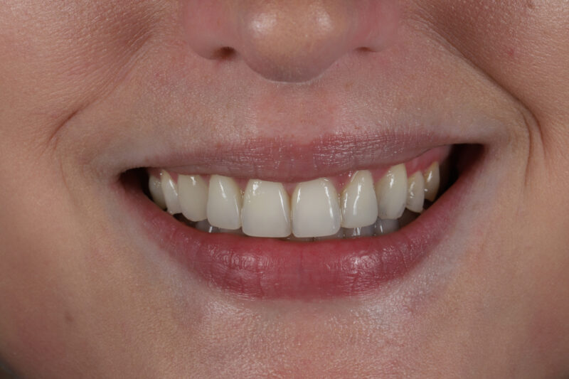 After - Cheadle Hulme Dental