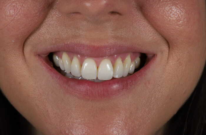 After - Cheadle Hulme Dental