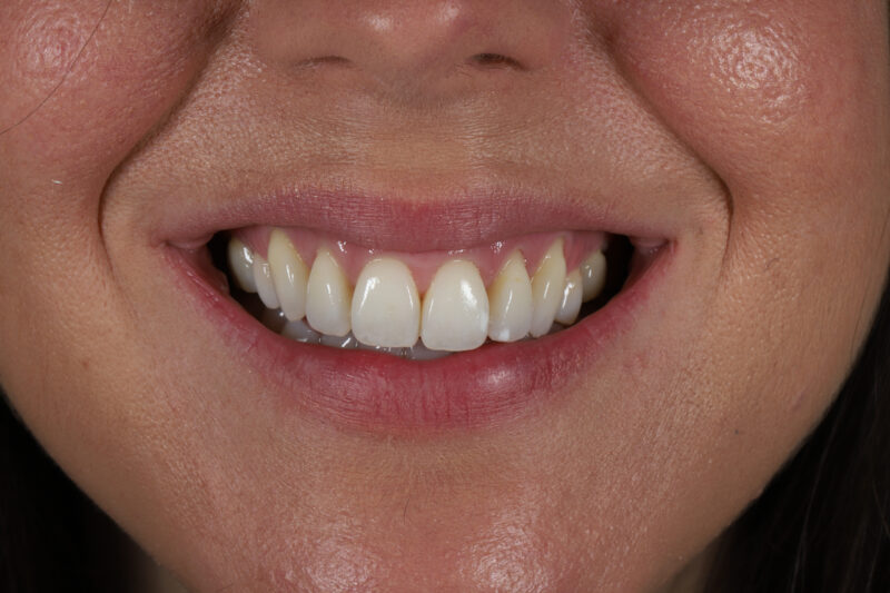 After - Cheadle Hulme Dental