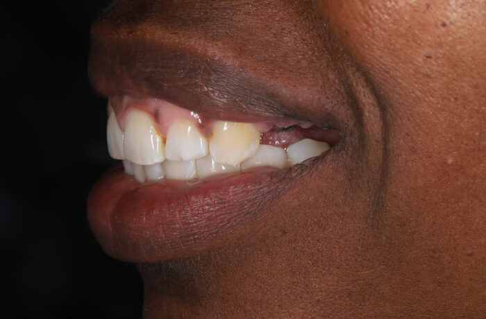 Before - Cheadle Hulme Dental