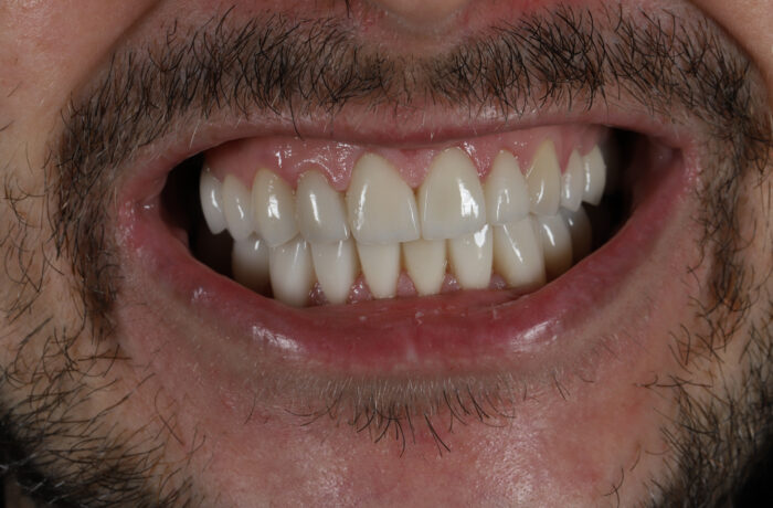 After - Cheadle Hulme Dental