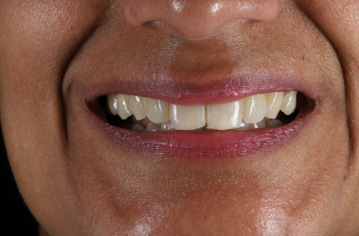 After - Cheadle Hulme Dental